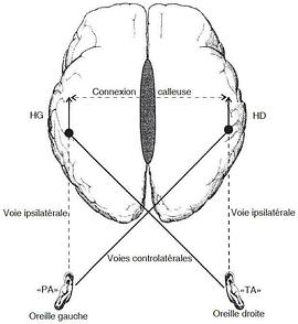 声音对视网膜相关性影响的实证研究封面图